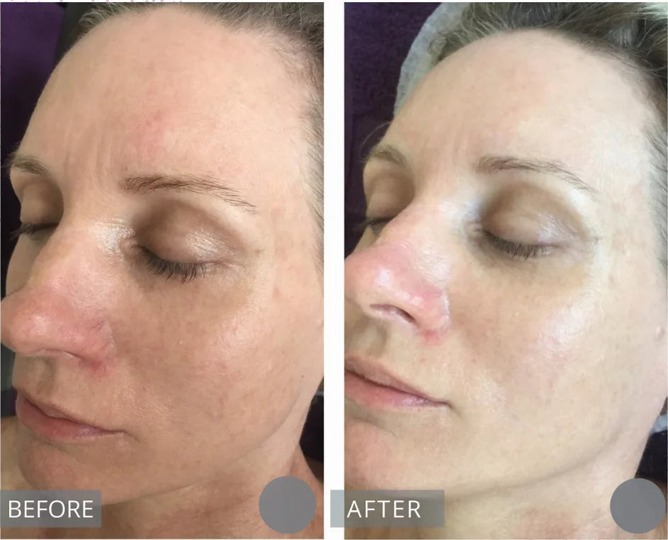 Korean Centella Serum with Hyaluronic Acid