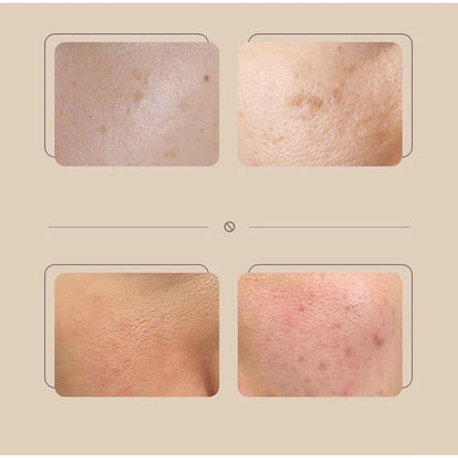 Korean Rice Extract Cream