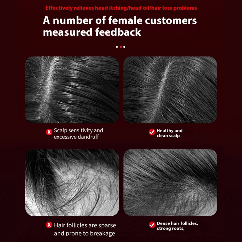 Elect Revive Scalp Comb