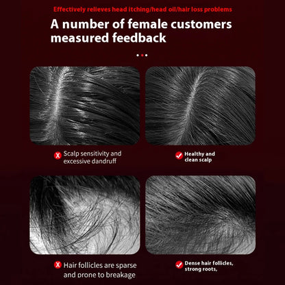 Elect Revive Scalp Comb