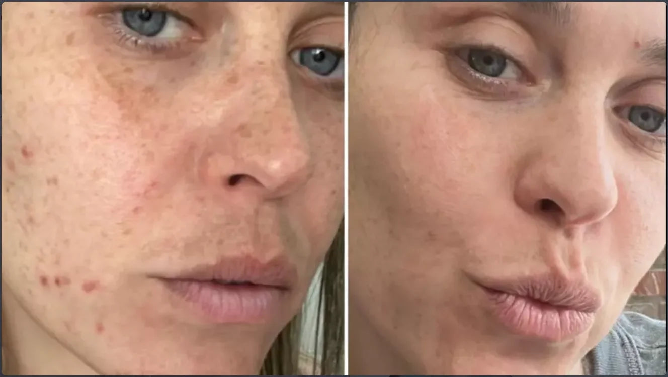 Korean Centella Serum with Hyaluronic Acid