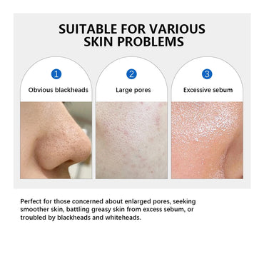 ✨ Korean Zero Pore– Double-Textured Facial Toner ✨