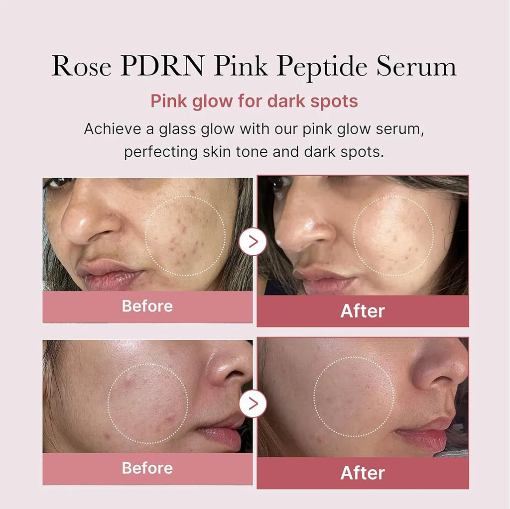 RadiantPink™ Collagen Serum
