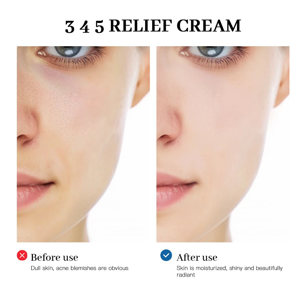 345 Relief Cream – The Complete Solution for Your Skin