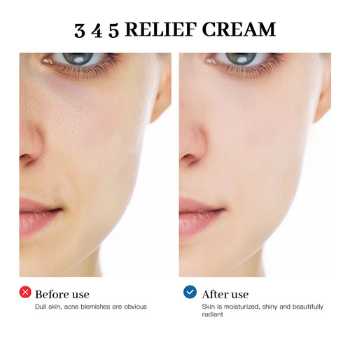 345 Relief Cream – The Complete Solution for Your Skin