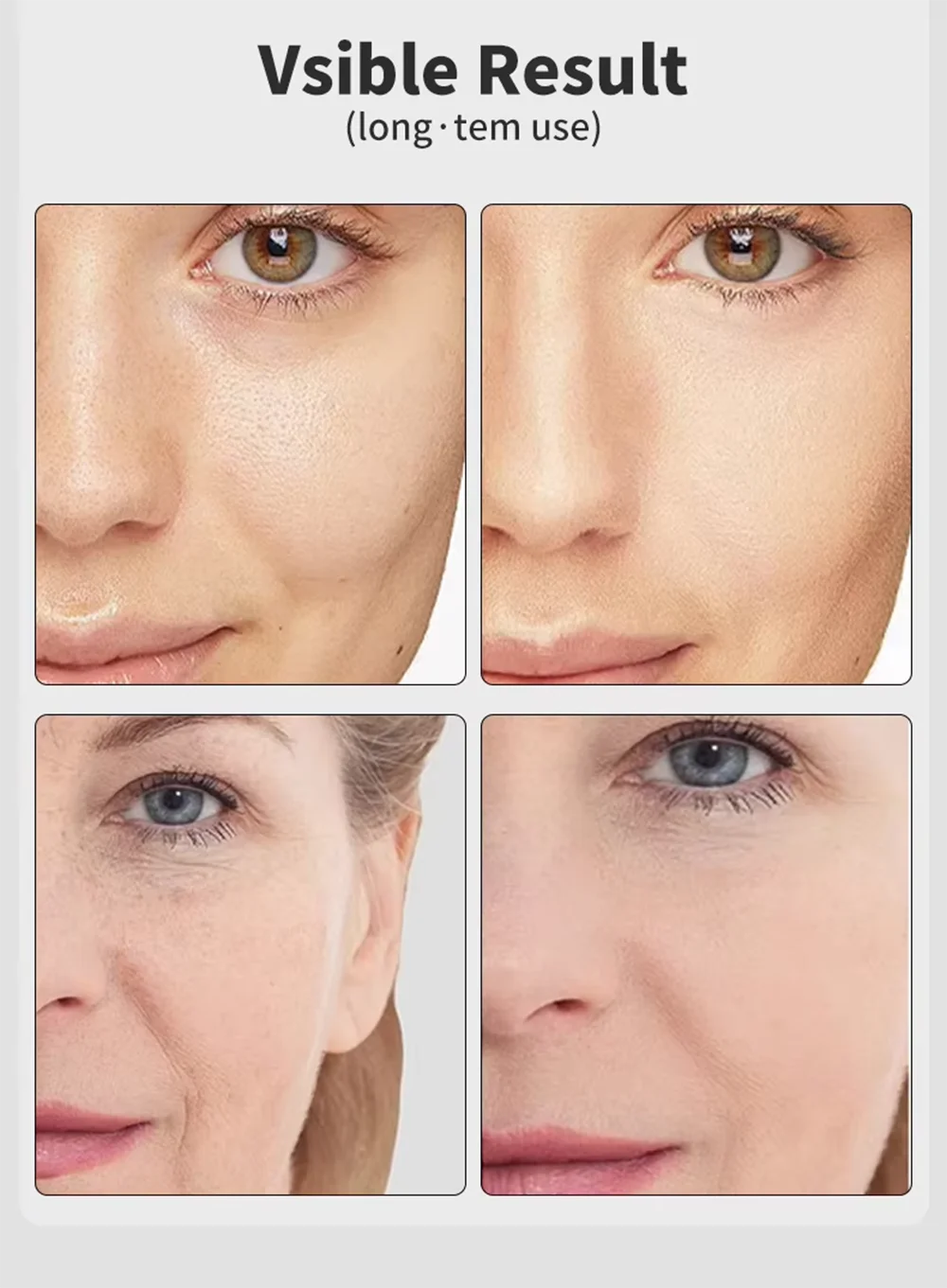 Glow Lift