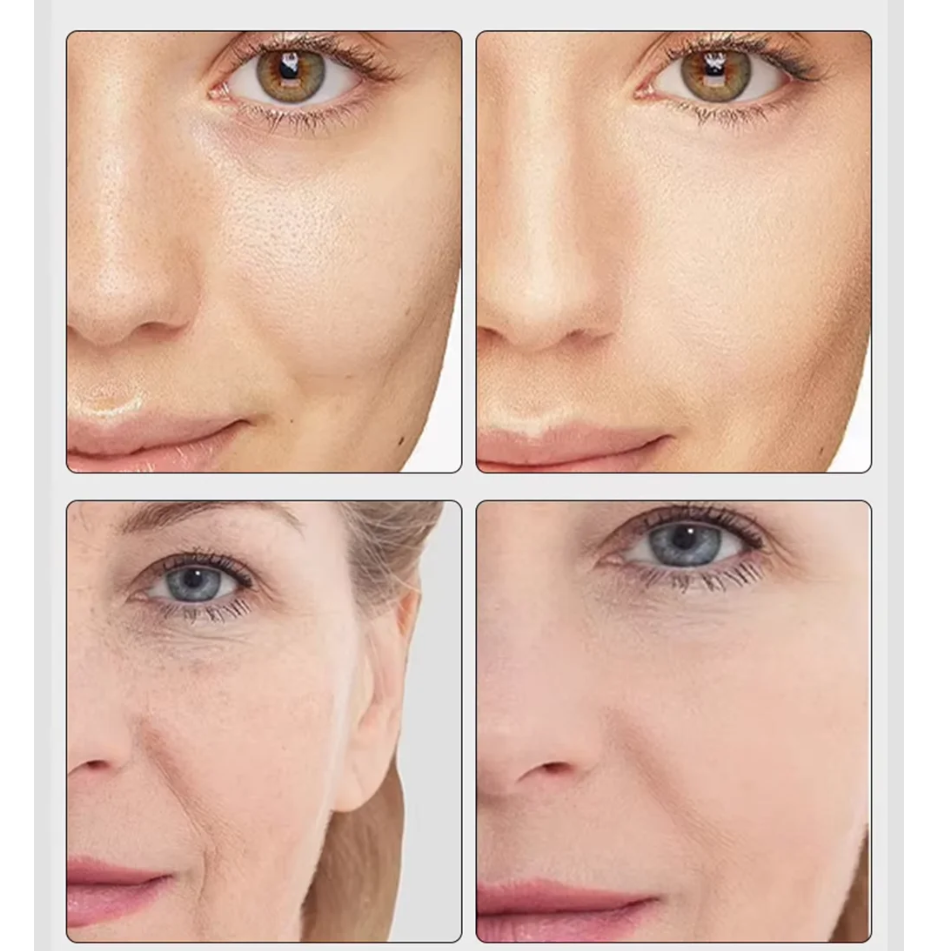 Glow Lift – Lift, Sculpt & Smooth