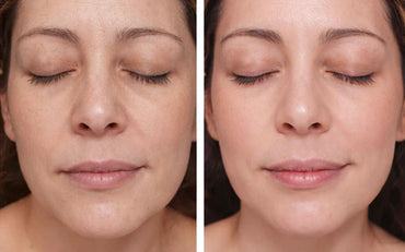 Glow Lift – Lift, Sculpt & Smooth